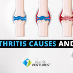 AVACEN thermo therapy for arthritis