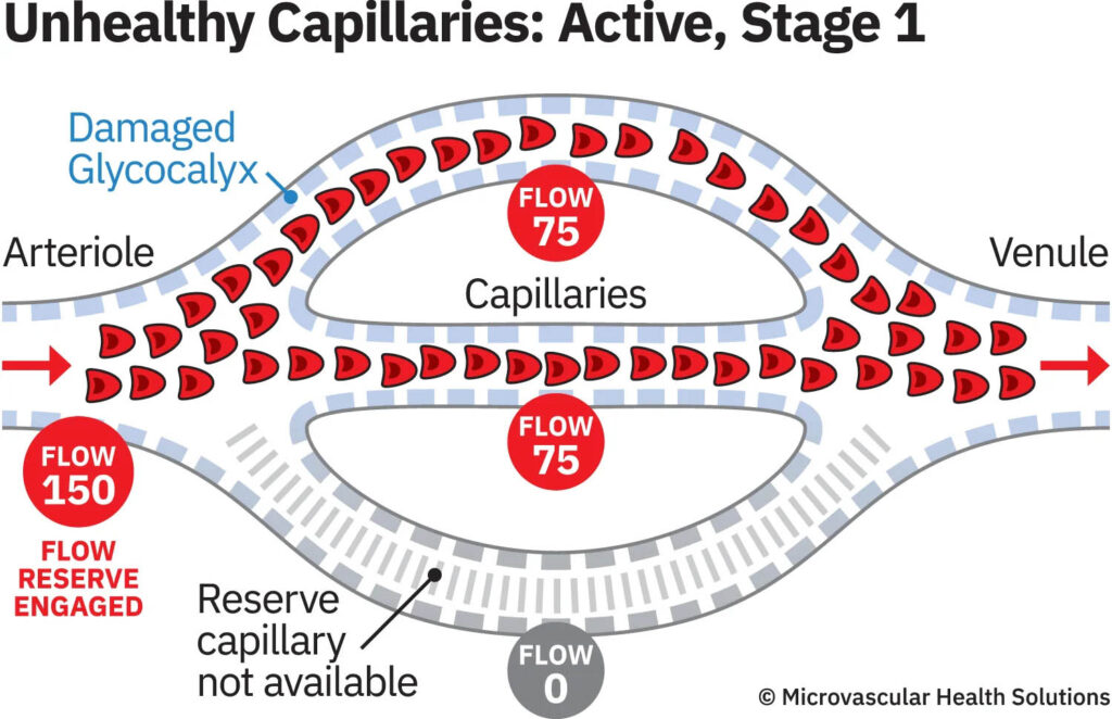 unhealthy capillaries active