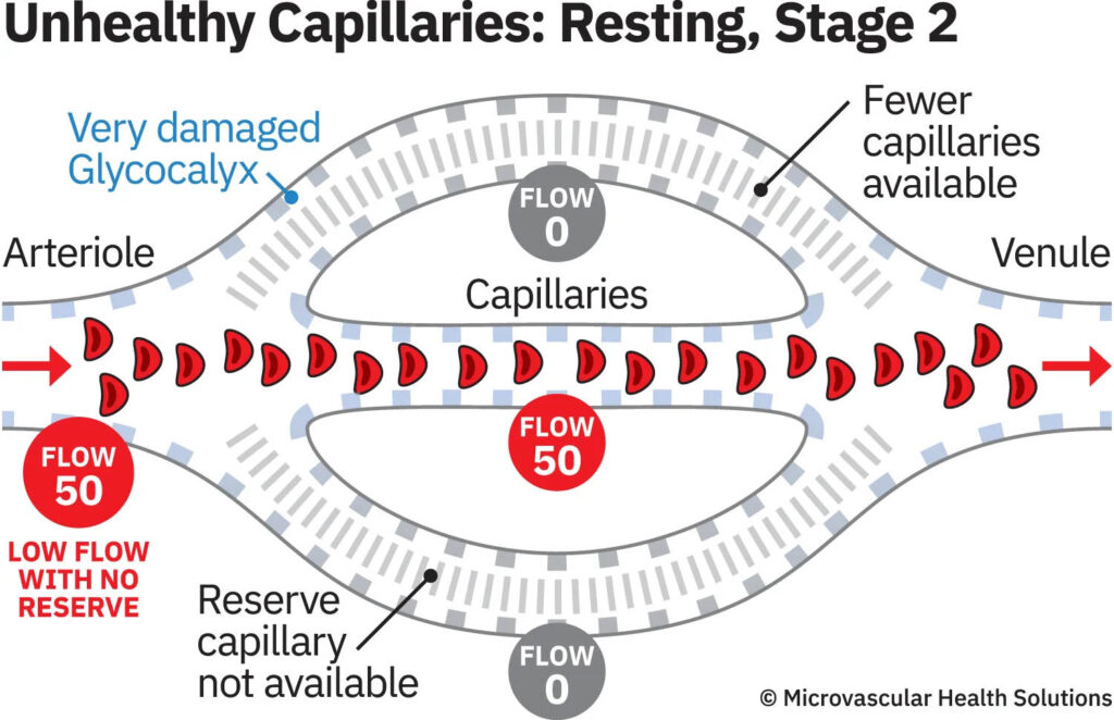 unhealthy capillaries resting